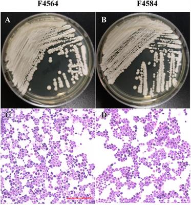 First two fungemia cases caused by Candida haemulonii var. vulnera in China with emerged antifungal resistance